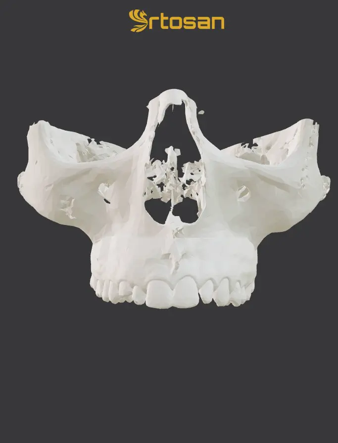 Visor 3D clínico